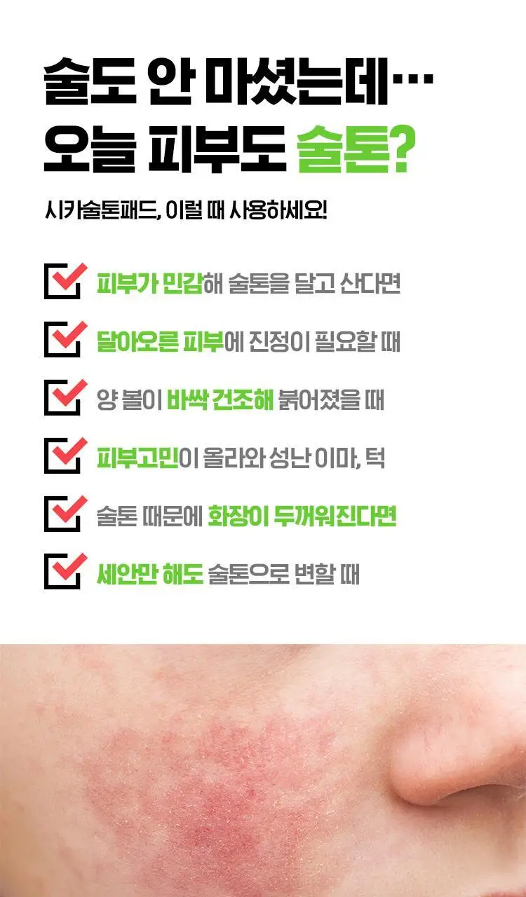 [시카술톤패드] 시카고 시카 스피디 카밍 패드 100g 70매 상세페이지 4